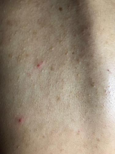 天网域名(吃辣第二天长痘痘)-图3 天网域名(吃辣第二天长痘痘)-图3